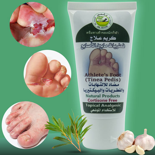 Athlete’s Foot  Antifungal Cream