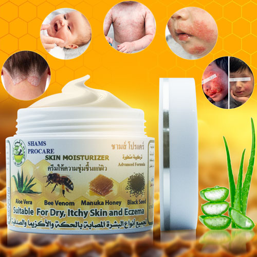 كريم الأكزيما والصدفية